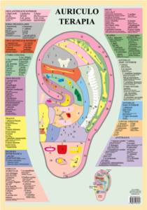 auriculoterapia